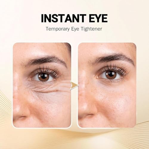 Image of Vita-A Retinal Shot Tightening Booster 0.1% Retinal Face SerumVita-A Retinal Shot Tightening Booster - 0.1% Retinal Face Serum with Matrixyl & Niacinamide, Anti Aging Korean Serum for Wrinkles, Pores, Fine Lines & Firm Skin.