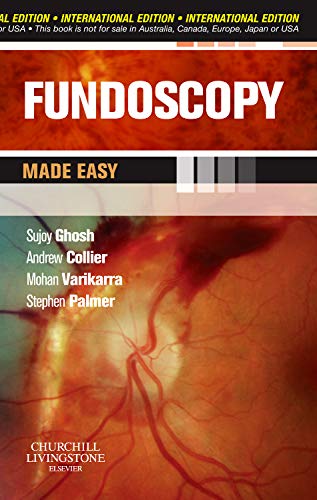 Buy Fundoscopy Made Easy, International Edition — BookShops.in