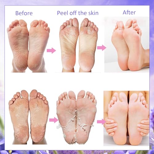 3 Pares Mascarillas Hidratantes para Pies, Mascarillas Exfoliantes de Pies de Lavanda Natural, Mascarilla para el Cuidado de los Pies, Calcetines SPA para Pies, Calcetín Humectante Desechables - imagen 6