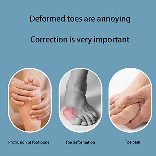 Samoka Toe Separators,6 Pcs Gel Toe Separators To Correct Bunions And Restore Toes To Their Original Shape [3 Pairs](Blue/Pink/White) #TOP1