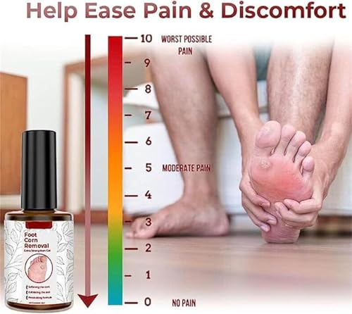 Image of BINGEABLE CornCare Foot Gel | Fast-Acting Corn & Callus Remover | Gentle Formula for Soft Feet | 30ml
