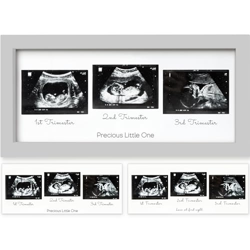 Image of Sonogram Picture Frame - Trio Ultrasound Picture Frames For Mom To Be Gift - Baby Ultrasound frame - Pregnancy Announcements Sonogram frame - Baby Nursery Decor, Pregnant Mom Gifts (Cloud Gray)