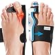 Miss Mouth’s 2 Stücke Hallux Valgus Schiene Korrektur - Mit 2 x Zehenspreizer, 2 Fersenverstellriemen, Schmerzlinderung und Schutz, Verstellbare Passform, für Herren und Damen Tag und Nacht (Schwarz)