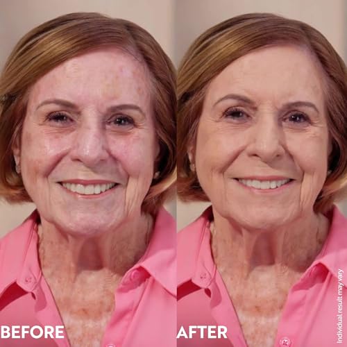 M. Asam Magic Finish Make-Up Mousse (1.01 Fl Oz) – 4in1 Primer, Foundation, Concealer & Powder With Buildable Coverage, Hides Redness And Dark Spots, Vegan, For Light To Medium Skin Tones