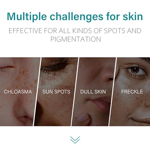 ARCHIDATE Dark Spot Remover Cream - Pigmentflecken entferner Gesicht Cream - Niacinamid Freckle Creme - Gesichtspflege Gesichtscreme Damen - Dunkle Flecken Entferner für Gesicht Feuchtigkeitscreme