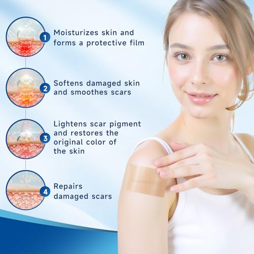 Image of Silicone Scar Sheets, Silicone Scar Tape(1.6 inch x 120 inch Roll 3M), Silicone Scar Sheets for Surgical Scars, Keloid Bump Removal, Stretch Marks Removal, C-Section, Burn et
