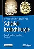 Schädelbasischirurgie: Therapiewahl und operatives Vorgehen