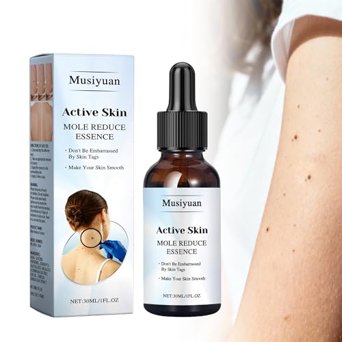 Musiyuan Facial and body mole and skin growth removal serum fast-acting precise dropper design effectively removes various warts (30ml)