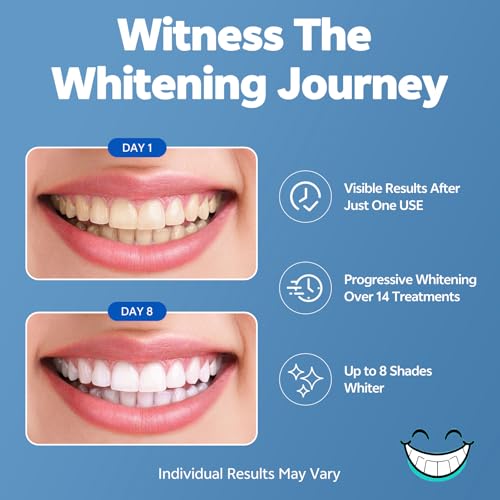 Image of Teeth Whitening Strips, 14-Day Treatments Clinically Proven for Visible & Affordable Teeth Whitening, Enamel Care Whitening, Reduced Sensitivity Formula, Mint.