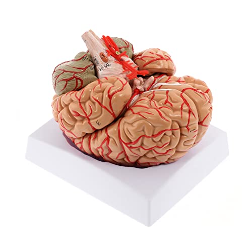 WICHEMI Brain Model