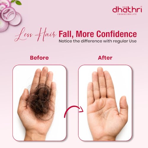 Image of Dhathri Onion Bringa Oil with Indian Aloe, Curry Leaf & Ashwagandha | Onion Hair Growth Oil for Thick & Healthy Hair | No Mineral Oils, SLS & Silicones | Ayurvedic Hair Oil | All Hair Types, 200ml