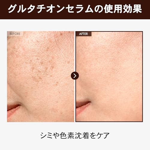 TOSOWOONG グルタチオンセラム 30ml の商品画像 1
