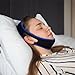 Anti Snore Chin Strap for Women & Men - Double-Support Chin Straps for Sleeping - Adjustable via Hook & Loop Closure - Skin-Friendly, with Holes for Aeration - Snoring Prevention Device - by Mobi Lock