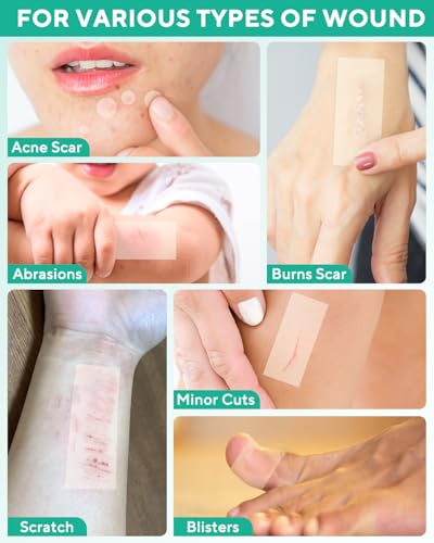 ZETRALL Hydrocolloid Roll for Wound Care, Large Cut-to-Size Hydrocolloid Patch Bandages wi - image 6