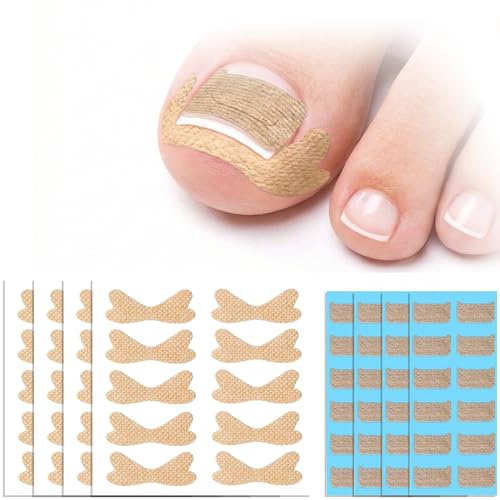88Pcs Ingrown Toenail Corrector Strips 2 Types Breathable Toe Nail Straightener Patch Professional Pedicure Tool Kit for Curved Nail Correction & Walking Comfort (Nude & Cute Styles)