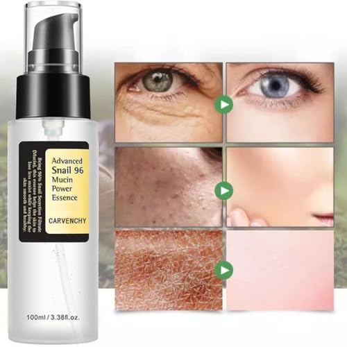 Advanced Snail Mucin 96% Power Repairing Essence,Hydrating Serum for Face with Snail Secretion Filtrate for Dull And Damaged Skin(100 ML) - Image 3