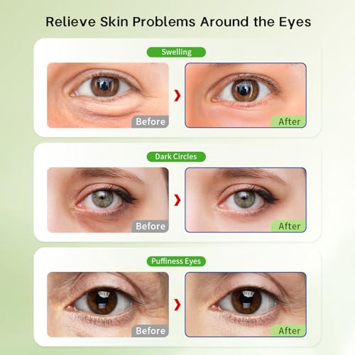 Image of ZNOCUETOD Reusable Gel Eye Pads for Puffiness & Dark Circles - Cold /Warm Therapy Compress with Cooling Under Eye Patches, Reduces Wrinkles & Redness, Pain Relief Eye Mask for Relaxation
