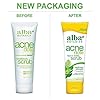 Alba Botanica Acnedote Face & Body Scrub, Maximum Strength 8 oz ( Pack of 3)
