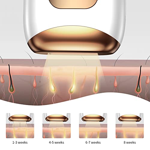 Ipl Hair Removal For Women At-Home,Upgraded To 999,000 Flashes Painless Hair Remover,Facial Hair Removal Device For Armpits Legs Arms Bikini Line #TOP1