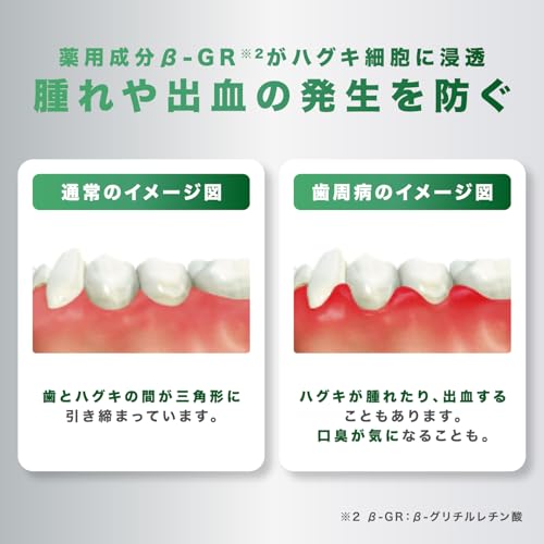GUM(ガム) 歯周プロケア 歯周病予防 ハグキケア 薬用ハミガキ 歯磨き粉 デンタルペースト レギュラータイプ メディカルミントタイプ の商品画像 5