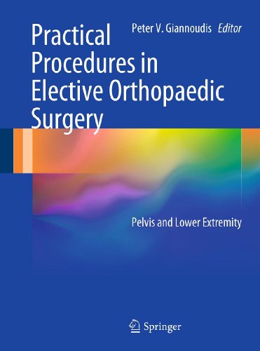 Télécharger Practical Procedures in Elective Orthopaedic Surgery: Pelvis and Lower Extremity (English Edition) Livre PDF Gratuit