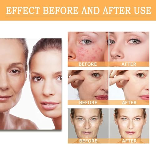 Tratamientos, Drugstore Imagen adicional