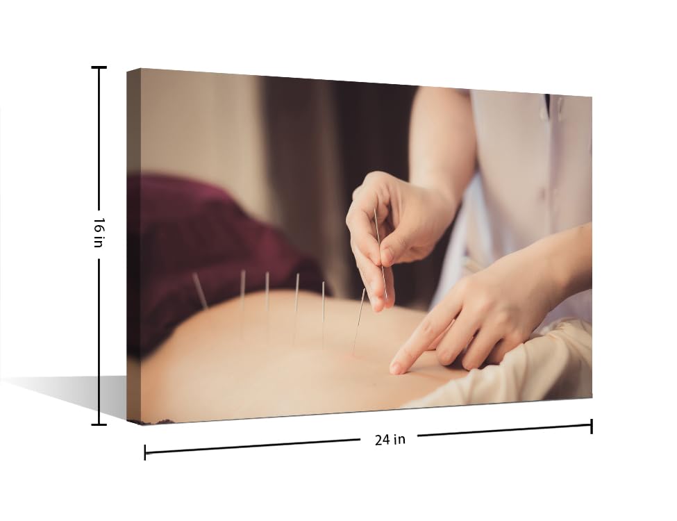 Image of TUMOVO Physical Therapists do Acupuncture Canvas Wall Art Traditional Chinese Medicine Canvas Photo 1 Panels Prints for Wall Decor Giclee Print Gallery Packaging Artwork Ready to Hang (16 inch Wx24 H)