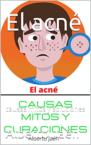 El acné: causas mitos y soluciones