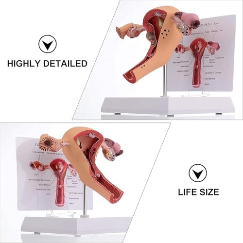 Modèle d’utérus humain pour l’enseignement des sciences médicales et anatomie