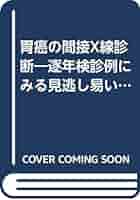 胃癌の間接Ｘ線診断 逐年検診例にみる見逃し易いタイプ/金芳堂/石田輝子（単行本） 胃癌をしっかり表そう！ 胃X線撮影法 虎の巻〜撮影手技を基本
