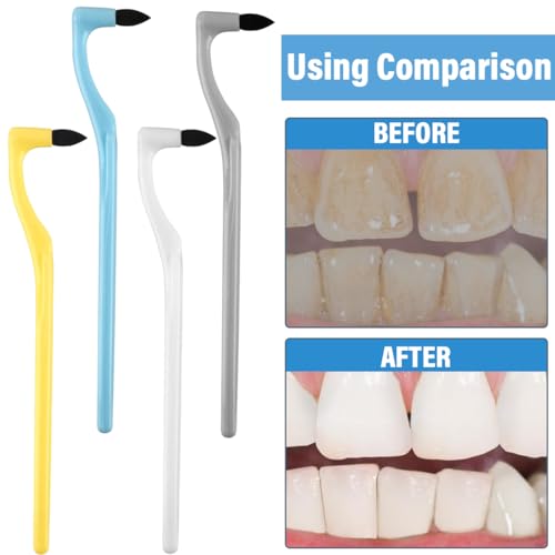 GYCAQAC Zahnsteinentferner, 6 Stück, Professionelle Zahnreinigung, Zahnpolierer, Geschmacklos, 4.99 Meter – Bild 5