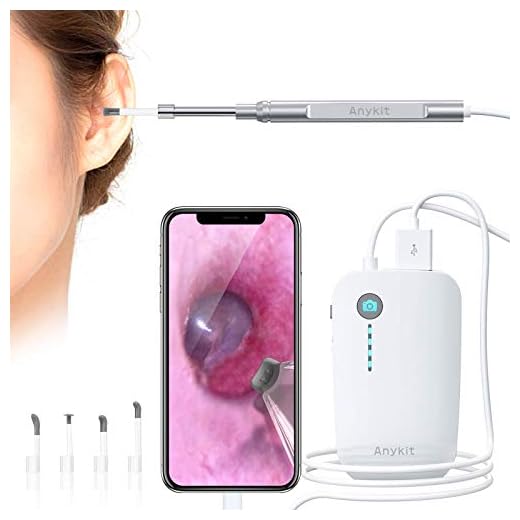 Otoscope iPhone, Anykit Upgraded 4.3mm 720P HD Ear Scope Camera Digital Otoscope with 6 LED Lights, Earwax Removal Tool and Specula for iPhone and Android Smartphone