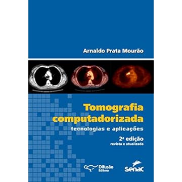 Capa do livro Tomografia computadorizada: tecnologias e aplicações