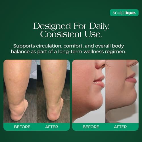 Image of Lymphatic Drainage Supplement - Lymphatic Drainage Capsules with Dandelion, Burdock, Cleavers & Echinacea, Supports Bloating, Fluid Balance & Daily Lymphatic Wellness - 60 Capsules