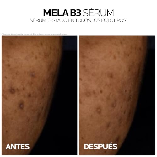 Miniatura 4 de La Roche-Posay, Mela B3 Sérum, Hiperpigmentación y manchas post acné, 30 ml