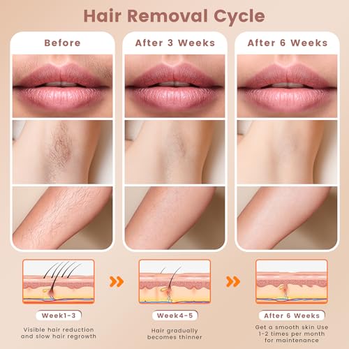 FELOOW IPL Hair Removal Device model S3 の商品画像 6