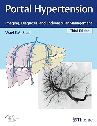 Portal Hypertension: Imaging, Diagnosis, and Endovascular Management