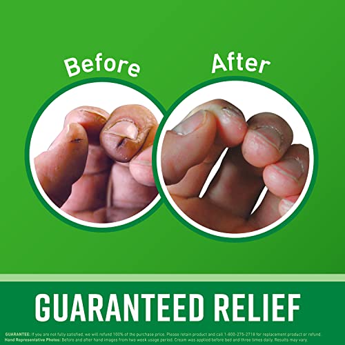 O'Keeffe's Working Hands Hand Cream, 6.8 oz Jar and Healthy Feet Foot Cream, 6.4 oz Jar - Repairing Skincare for Extremely Dry, Cracked Hands and Feet by O'Keeffe's - Image 2