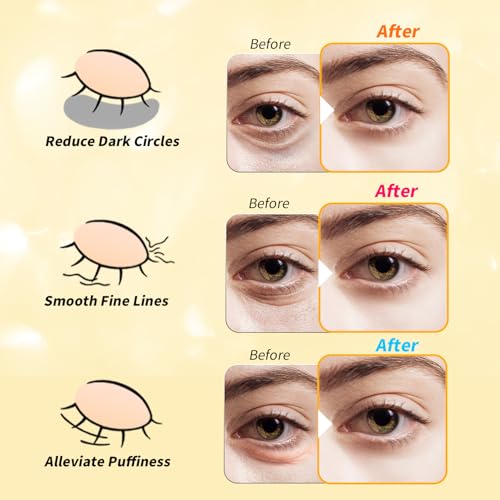 image for Tibobo Under Eye Patches(36 Pairs), 24K Gold, Caffeine, Retinol Eye Ma