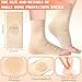 Geyoga 2 Pairs Ice Skating Socks for Women Tendon Heel Ankle Protector Padded Guards Ankle Sleeve Pad ski Splints(Beige Color)