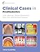 Clinical Cases in Prosthodontics