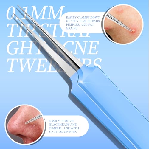 Teenitor 7 Pcs Professional Blackhead Remover Tweezers and Pimple Popper Tool Kit, Tweezers for Women Facial Hair, Blackhead Extractor, Pimple Extractor, Light Blue - Thumbnail 5