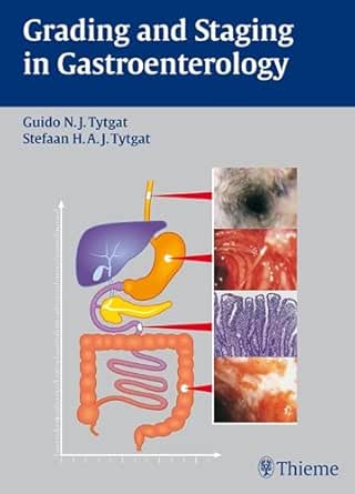 Grading and Staging in Gastroenterology book cover