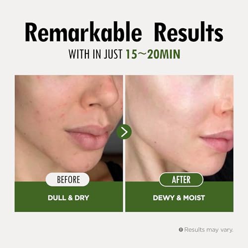 FARMSKIN Superfood Salad Sheet Mask Set of 6 | Korean Face Mask Sheets w/Mangosteen, Broccoli, Carrot, Coconut, Blueberry & Tomato | Refreshing, Nourishing & Cruelty-Free Face Mask Skincare Set - Image 7