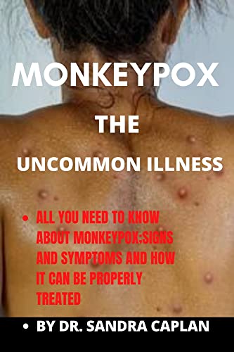 MONKEYPOX THE UNCOMMON ILLNESS : ALL YOU NEED TO KNOW ABOUT MONKEYPOX;SIGNS AND SYMPTOMS AND HOW IT CAN BE PROPERLY TREATED