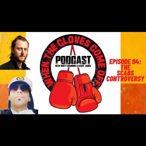 Episode 94 - The Scabs Controversy
