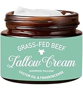 Nichalous Organic Grass Fed Whipped Tallow Cream with Castor Oil &amp; Frankincense Oil, All-Natural ...