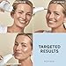 NuFACE Effective Lip & Eye Attachment for Trinity Microcurrent Facial Device, FDA Cleared - Depuffing, Line Smoothing, Plumping & Tightening Treatment for Hard-to-Reach Areas Around Mouth and Eyes