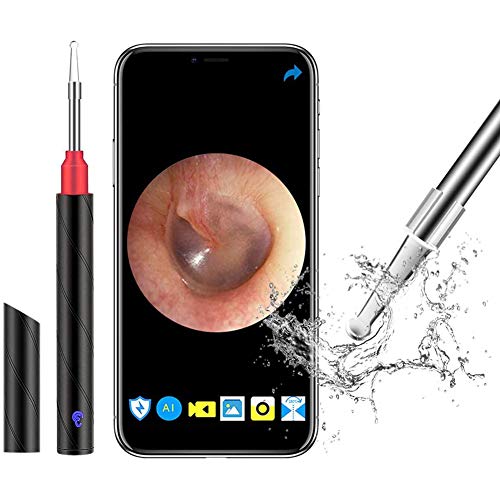 MSQL Wireless Otoscope Earwax Removal 1080P HD WiFi Ear Wax Remover Endoscope with Blue Light Disinfection Light, for Children, Adults, Pets