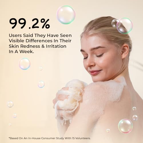 Image of Sunny Herbals Derm Aid Soap | Gentle on Sensitive Skin | Herbal Formula | For Daily Use | Clean & Clear Skin Naturally, 75 gm (Pack of 4)